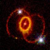 SN1987a